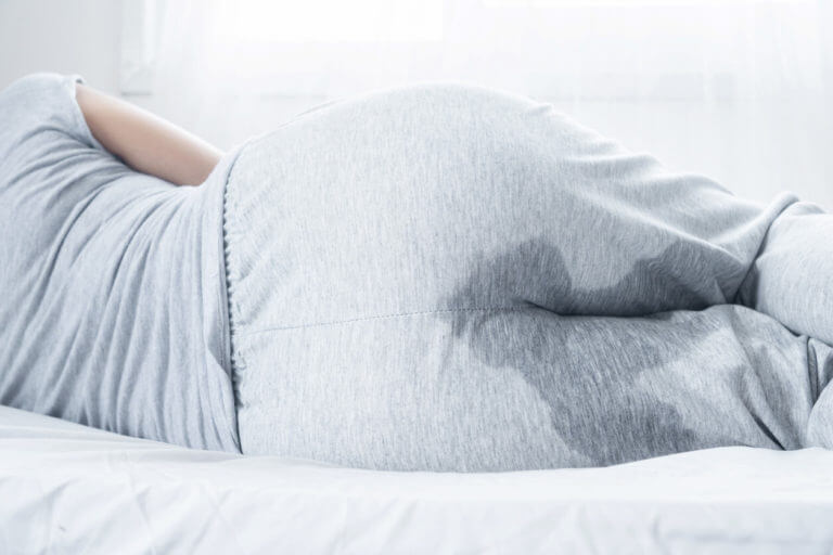 A woman with wet pants because of Stress urinary incontinence.